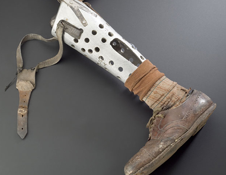 PROSTHESIS